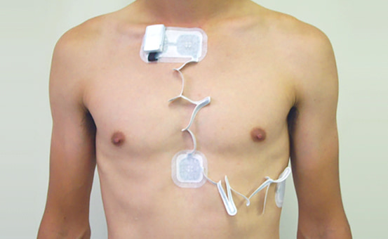 ホルター心電図